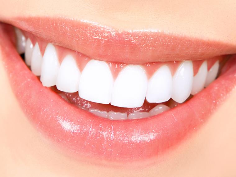 Blanchiment des dents dentiste-produit-sante-protection