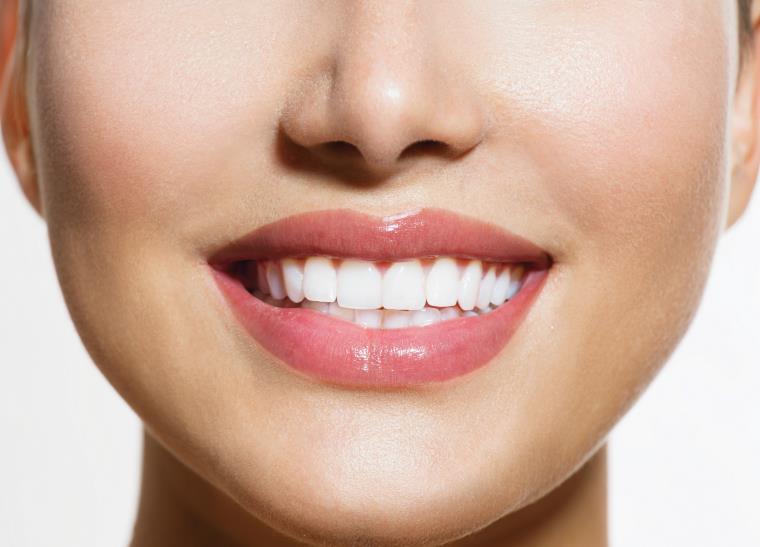 Blanchiment des dents sante-beaute-sourire-produit