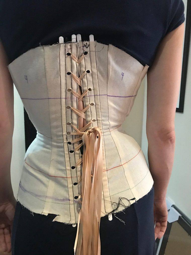 scoliose traitement long corsette