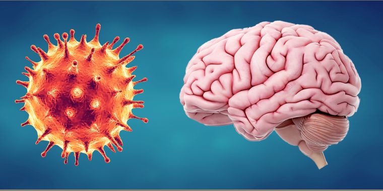 conséquences coronavirus sur le cerveau