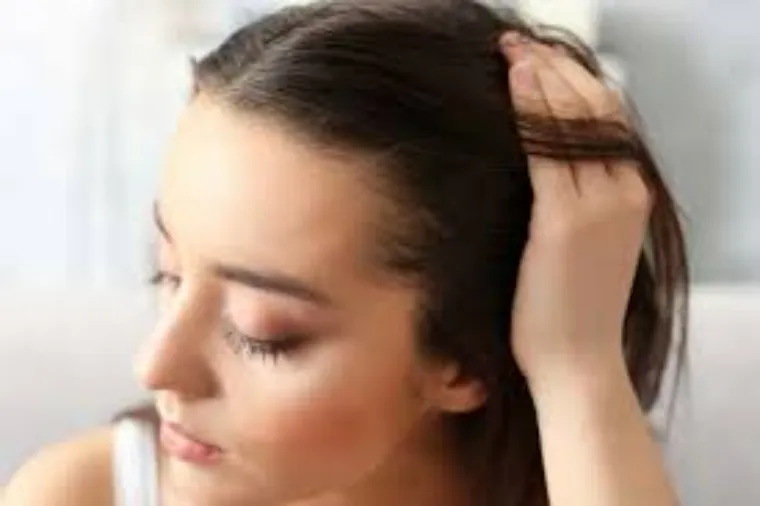 alopécie femme perte cheveux